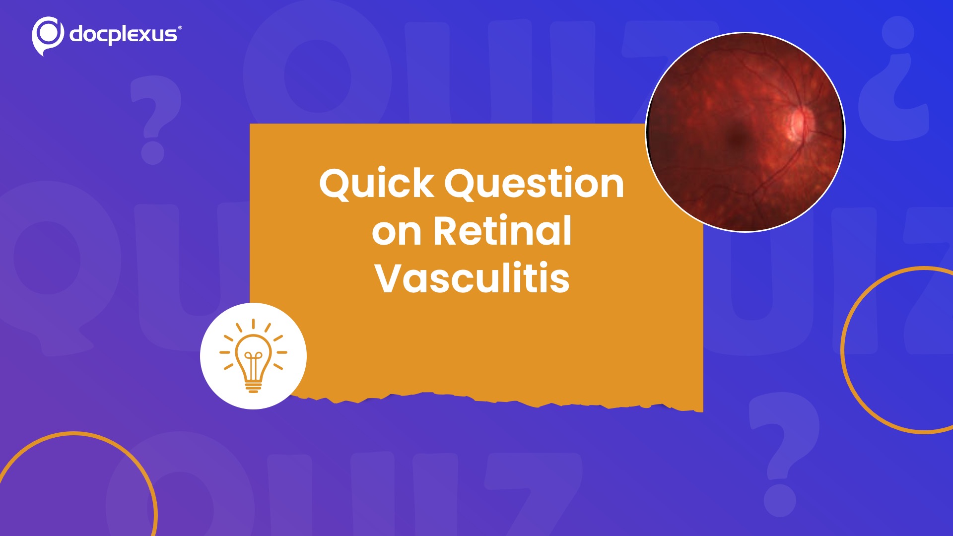Identify the Leading Systemic Cause of Retinal Vasculitis