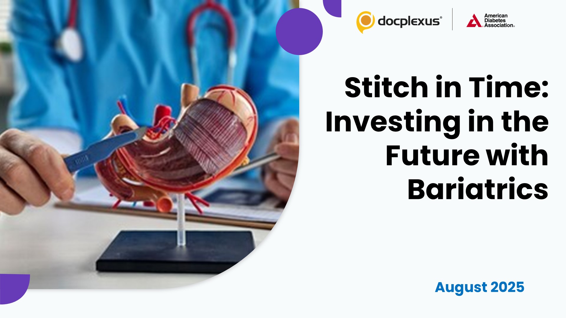 Bariatric Surgery for Type 2 Diabetes: A Strategic Investment in Long-Term Health and Cost Savings
