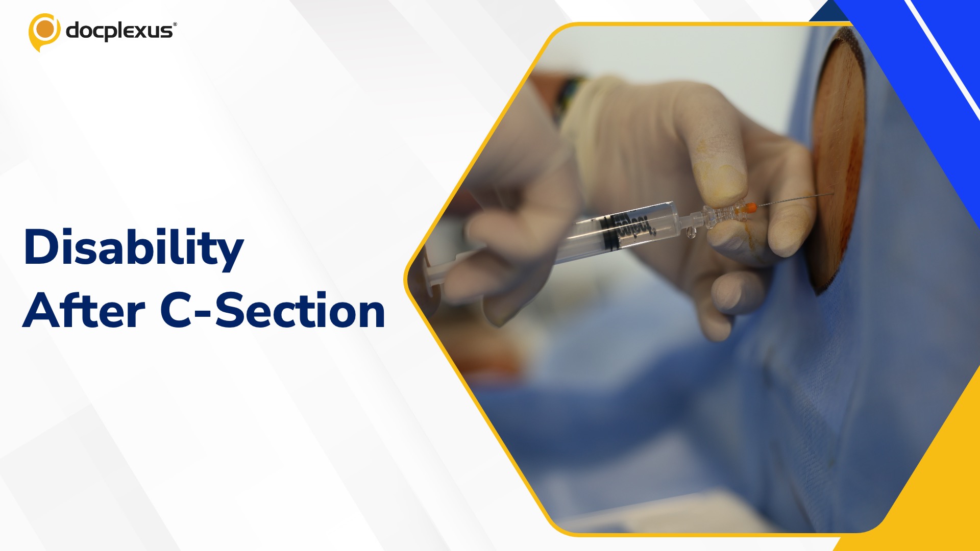 C-Section Case Ends in Compensation for Patient Disability