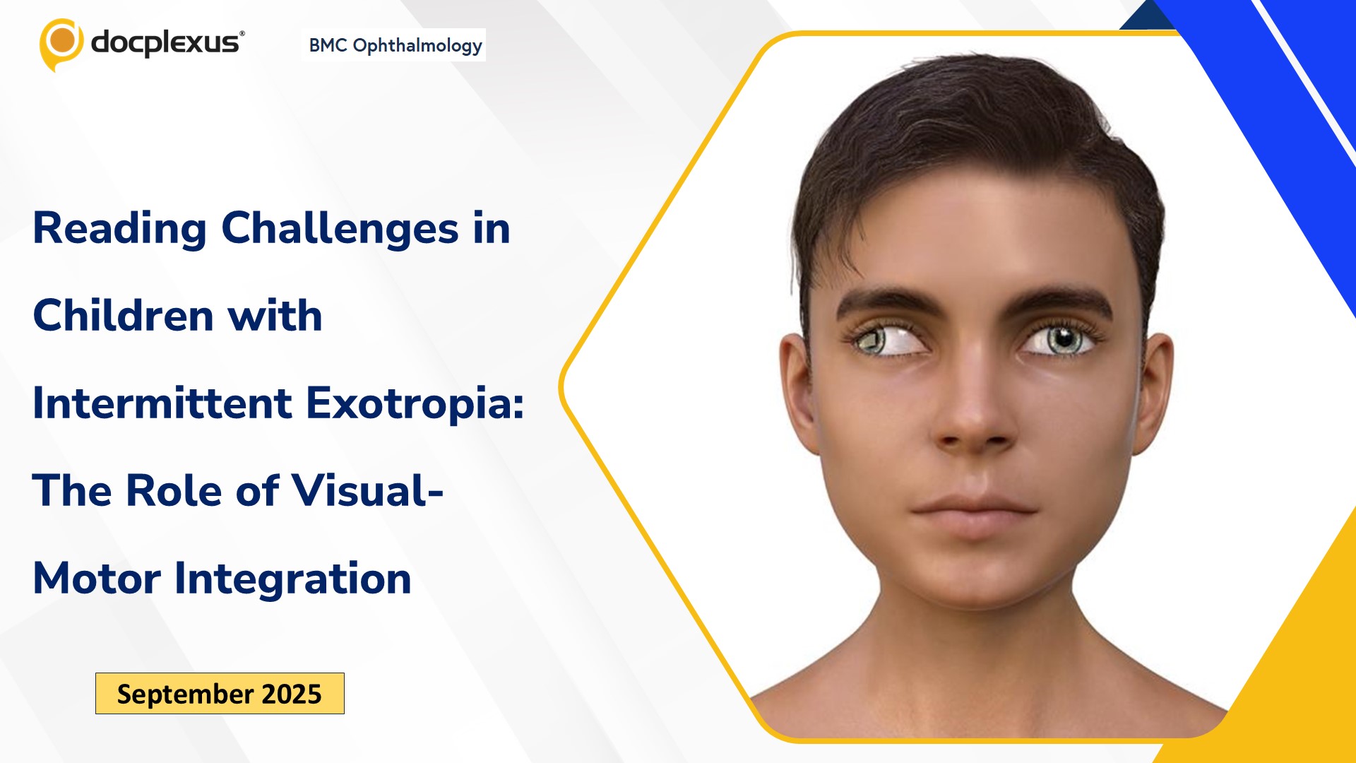 Reading Challenges in Children with Intermittent Exotropia: The Role of Visual-Motor Integration
