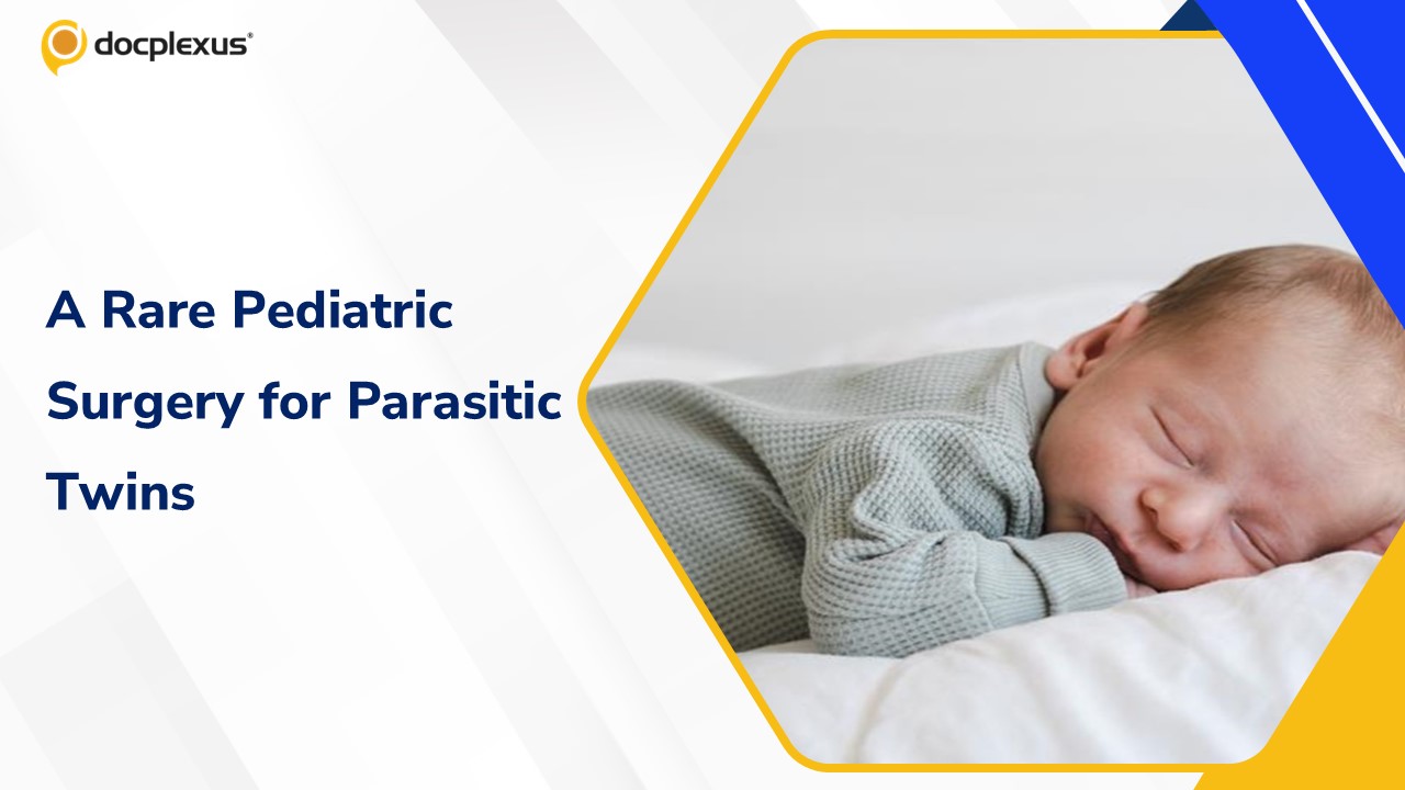 Rare Surgery Saves Life of 20-Day-Old Baby with Parasitic Twins