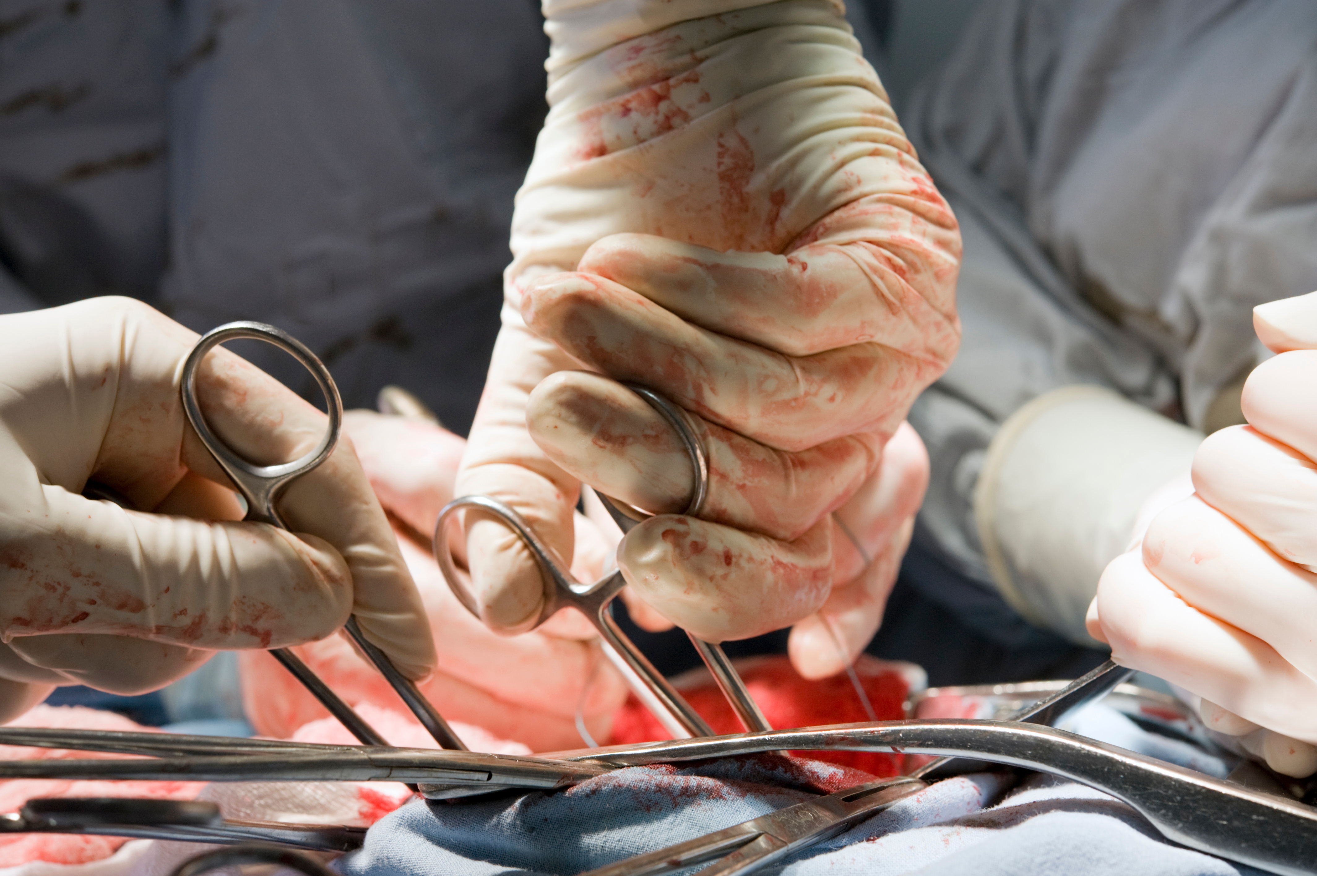 Acute Abdomen: A Clinical Overview