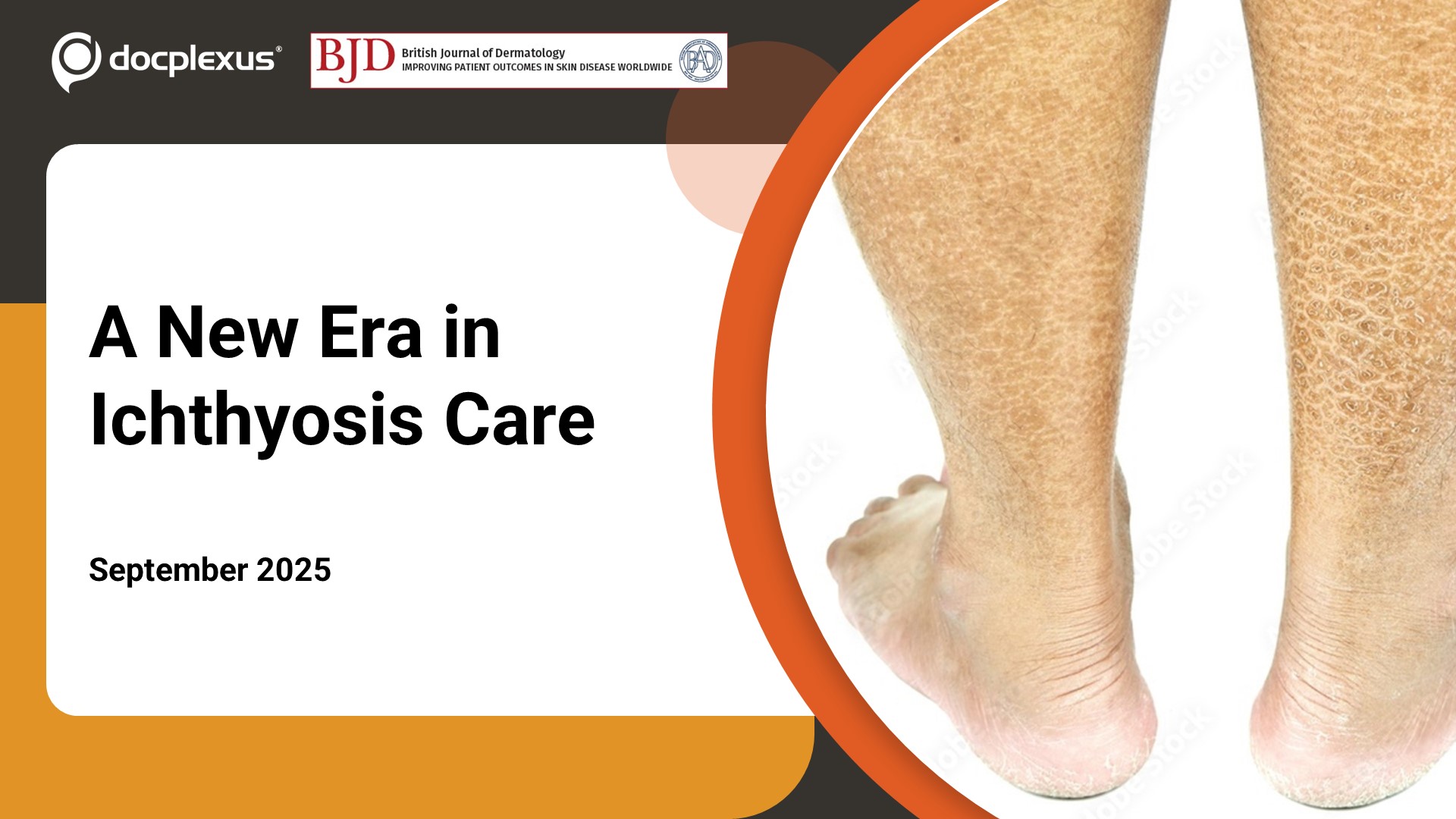 Pathogenesis-Based Therapies: Revolutionizing Ichthyosis Classification and Treatment