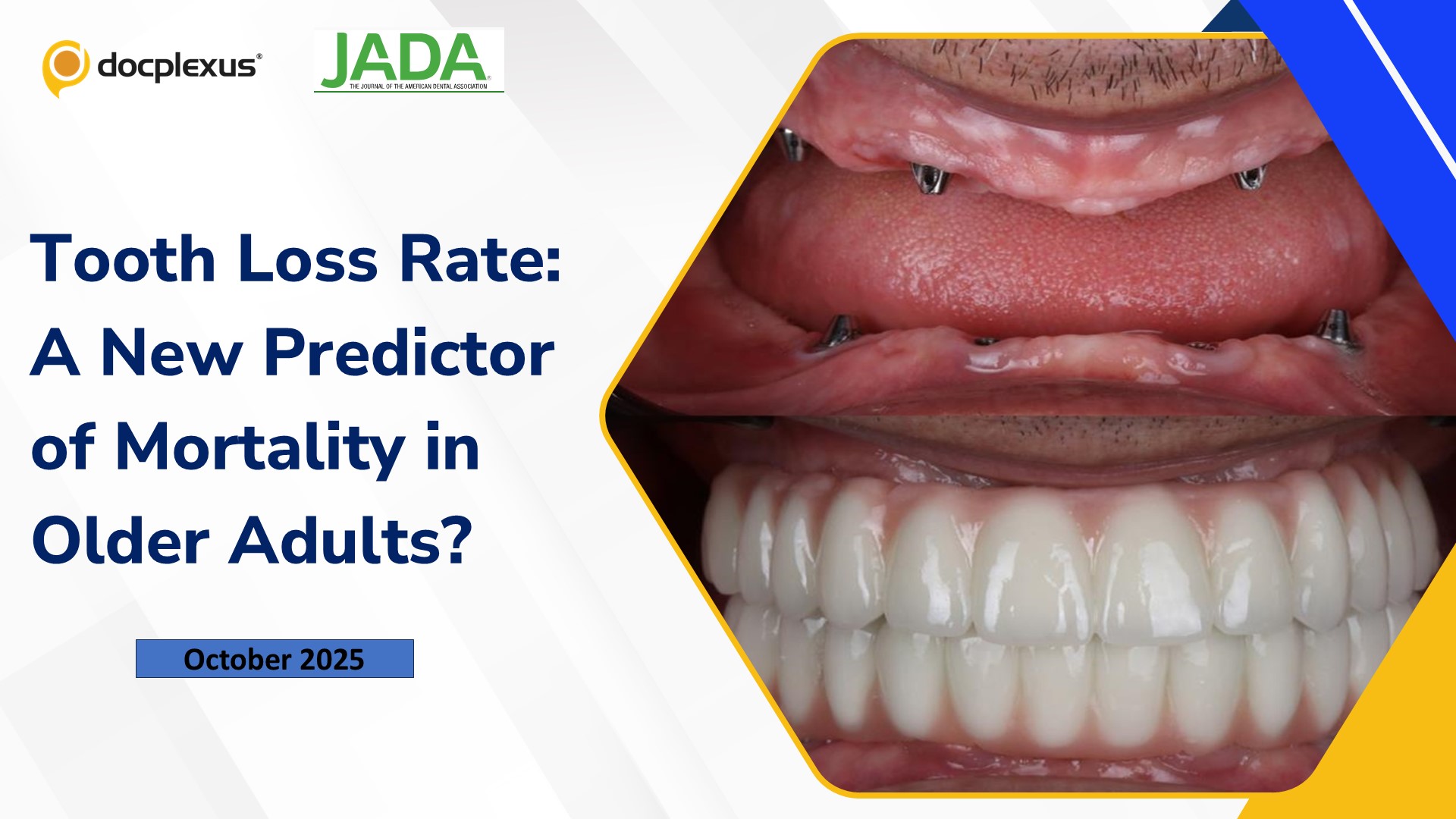 Tooth Loss Rate: A New Predictor of Mortality in Older Adults?
