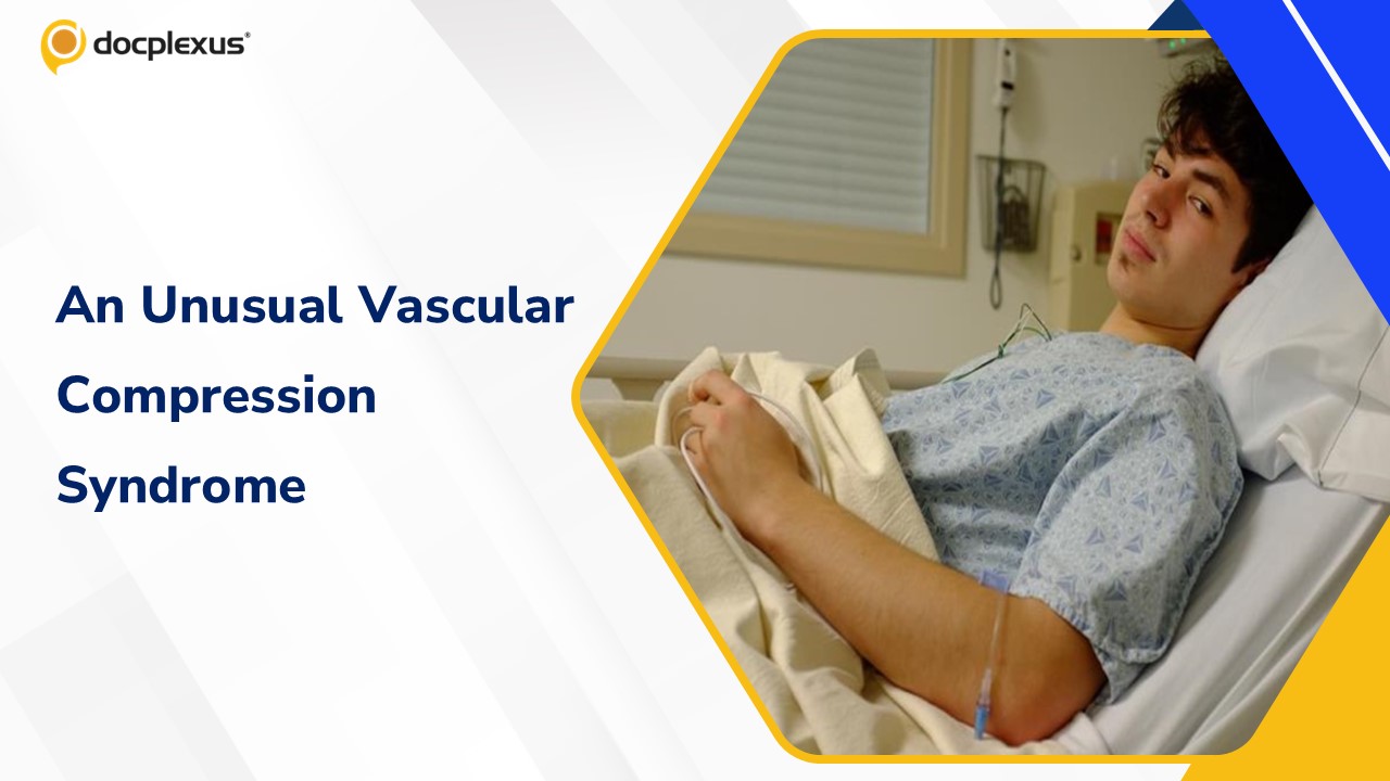 Diagnosis of a Rare Vascular Compression in an Adolescent