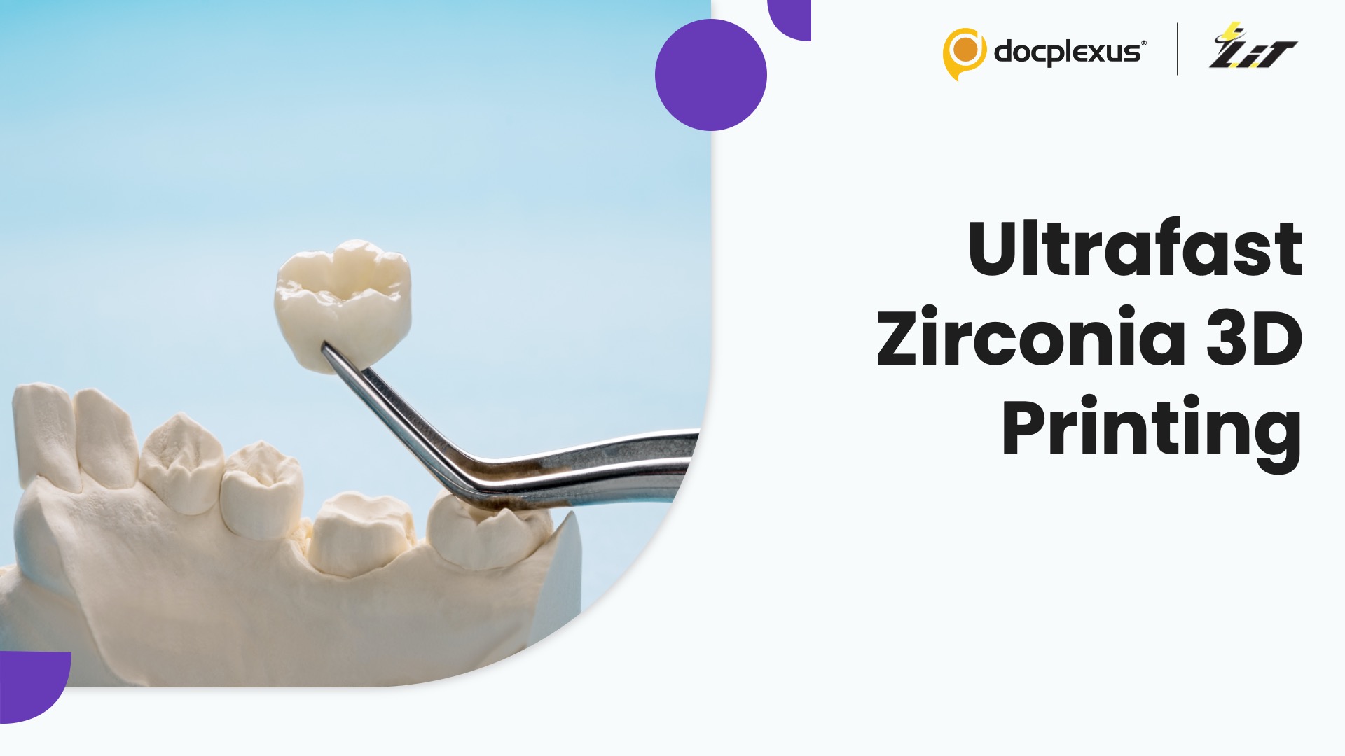 3D-Printed Zirconia Crowns: Same-Day Restorations May Soon Be Reality