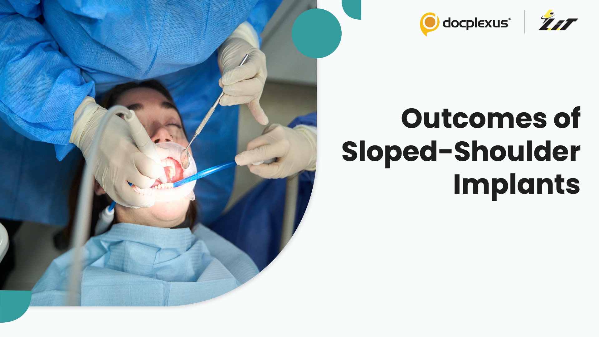 Sloped-Shoulder Implants Reduce Bone Loss and Surgical Complexity