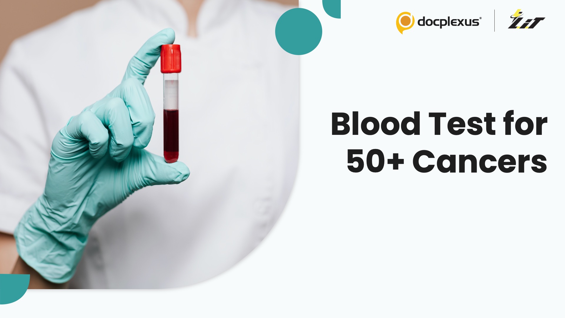 Blood Test Shows Promise in Detecting Over 50 Cancers Early