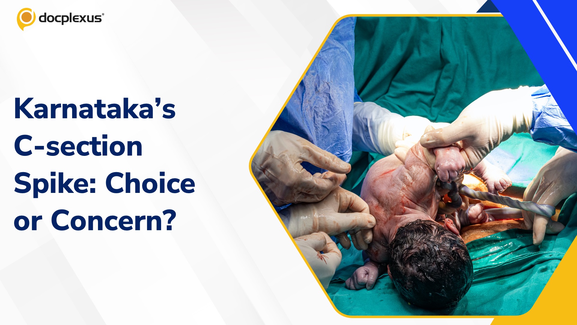 Karnataka’s Soaring C-section Rates Raise Red Flags in Maternal Care