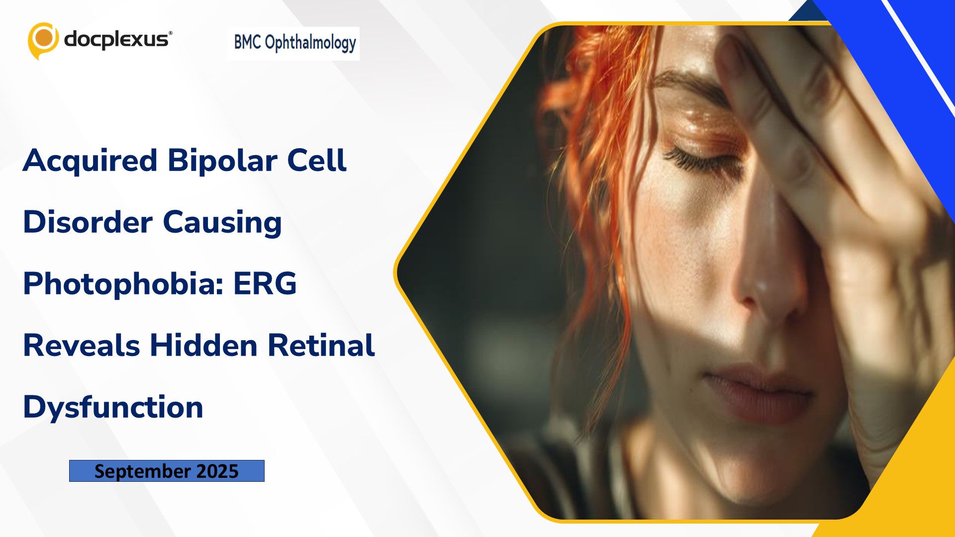 Acquired Bipolar Cell Disorder Causing Photophobia: ERG Reveals Hidden Retinal Dysfunction