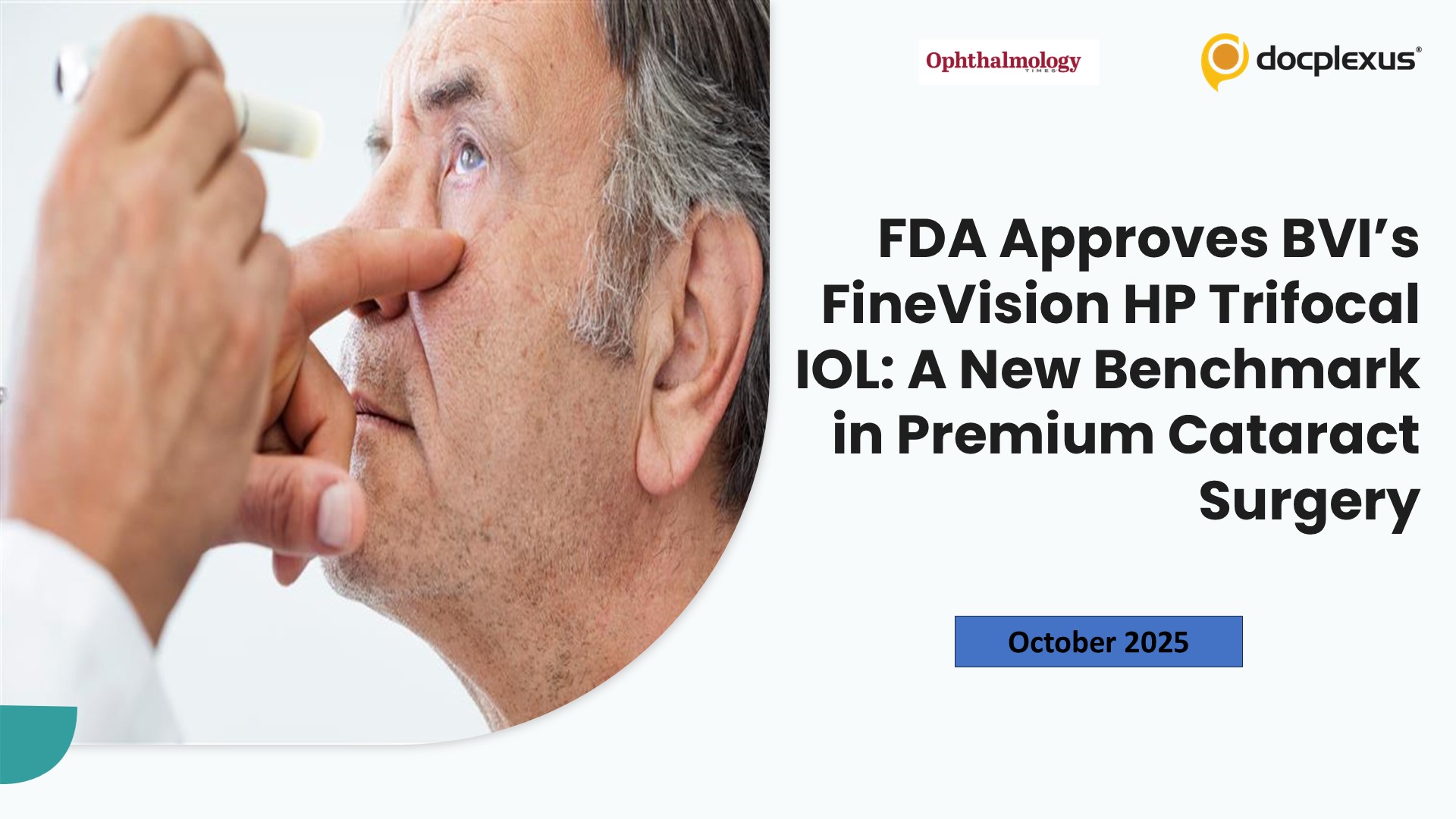 FDA Approves BVI’s FineVision HP Trifocal IOL: A New Benchmark in Premium Cataract Surgery