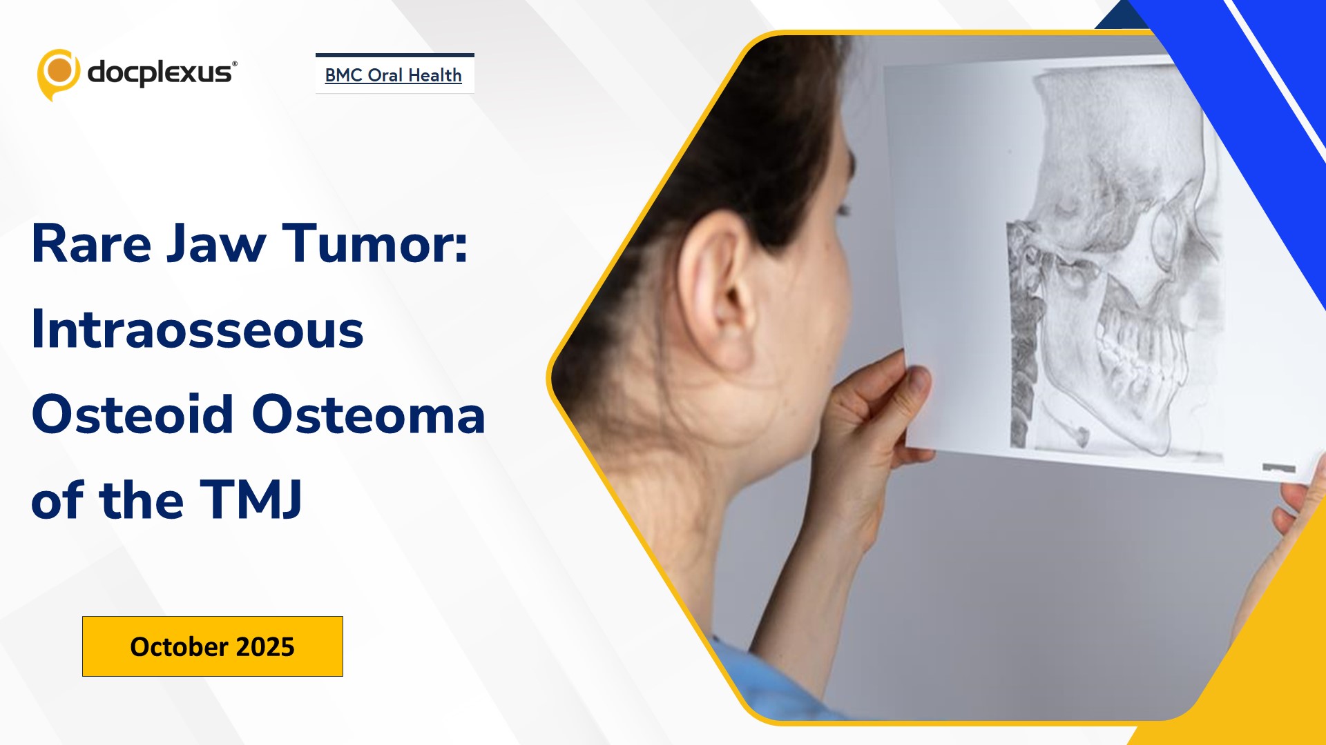 Rare Jaw Tumor: Intraosseous Osteoid Osteoma of the TMJ
