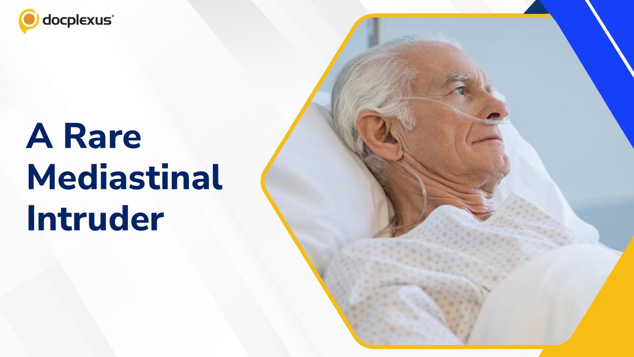 Unmasking a Rare Mediastinal Intruder in a 70-Year-Old