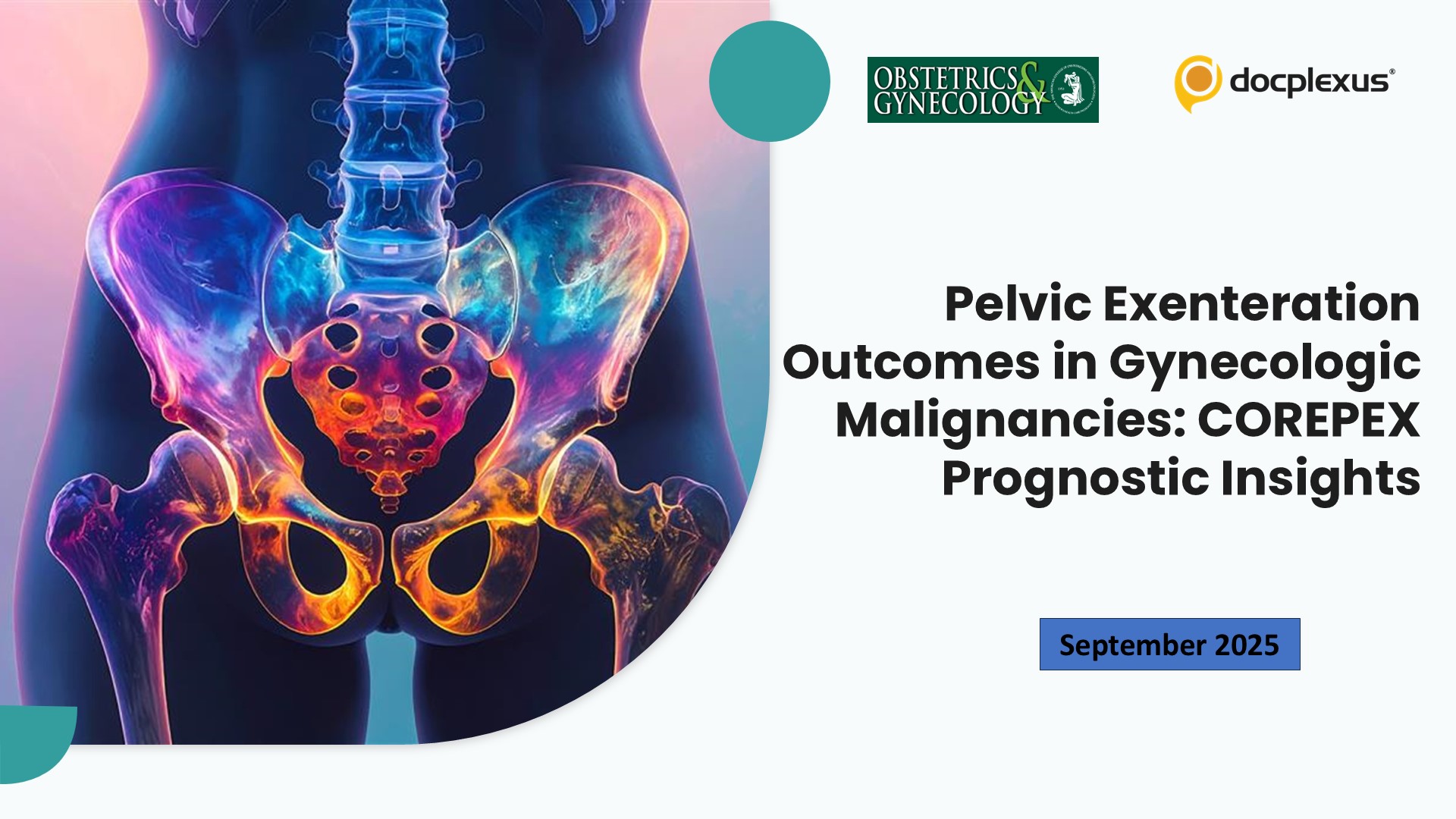 Pelvic Exenteration Outcomes in Gynecologic Malignancies: COREPEX Prognostic Insights