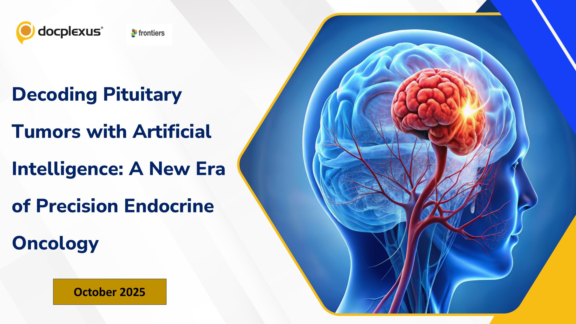 Decoding Pituitary Tumors with Artificial Intelligence: A New Era of Precision Endocrine Oncology