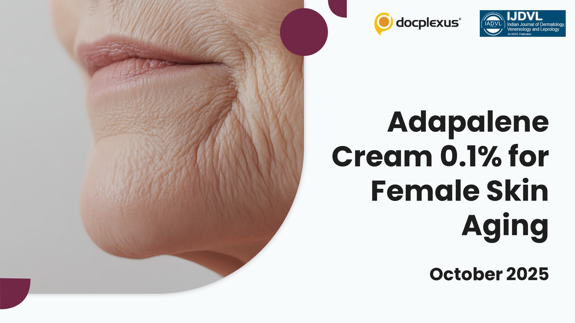 Can Adapalene Cream 0.1% Reverse Skin Aging in Women?