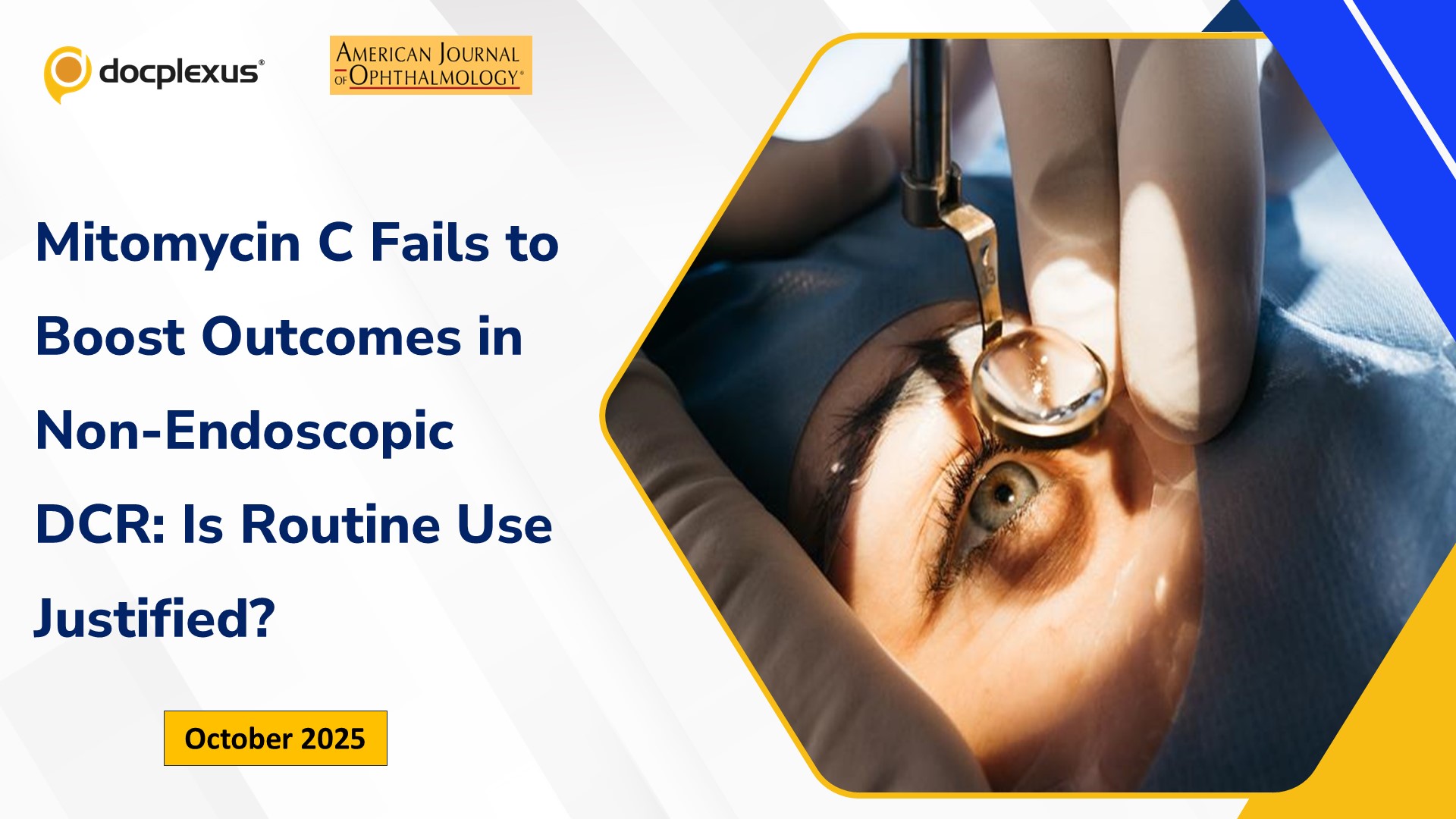 Mitomycin C Fails to Boost Outcomes in Non-Endoscopic DCR: Is Routine Use Justified?