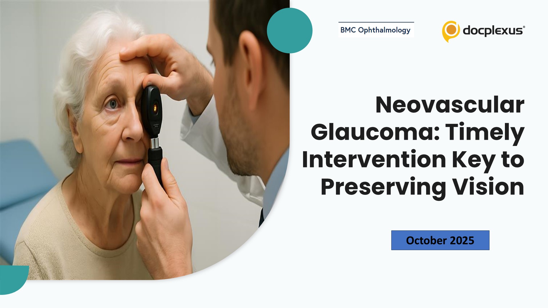 Neovascular Glaucoma: Timely Intervention Key to Preserving Vision