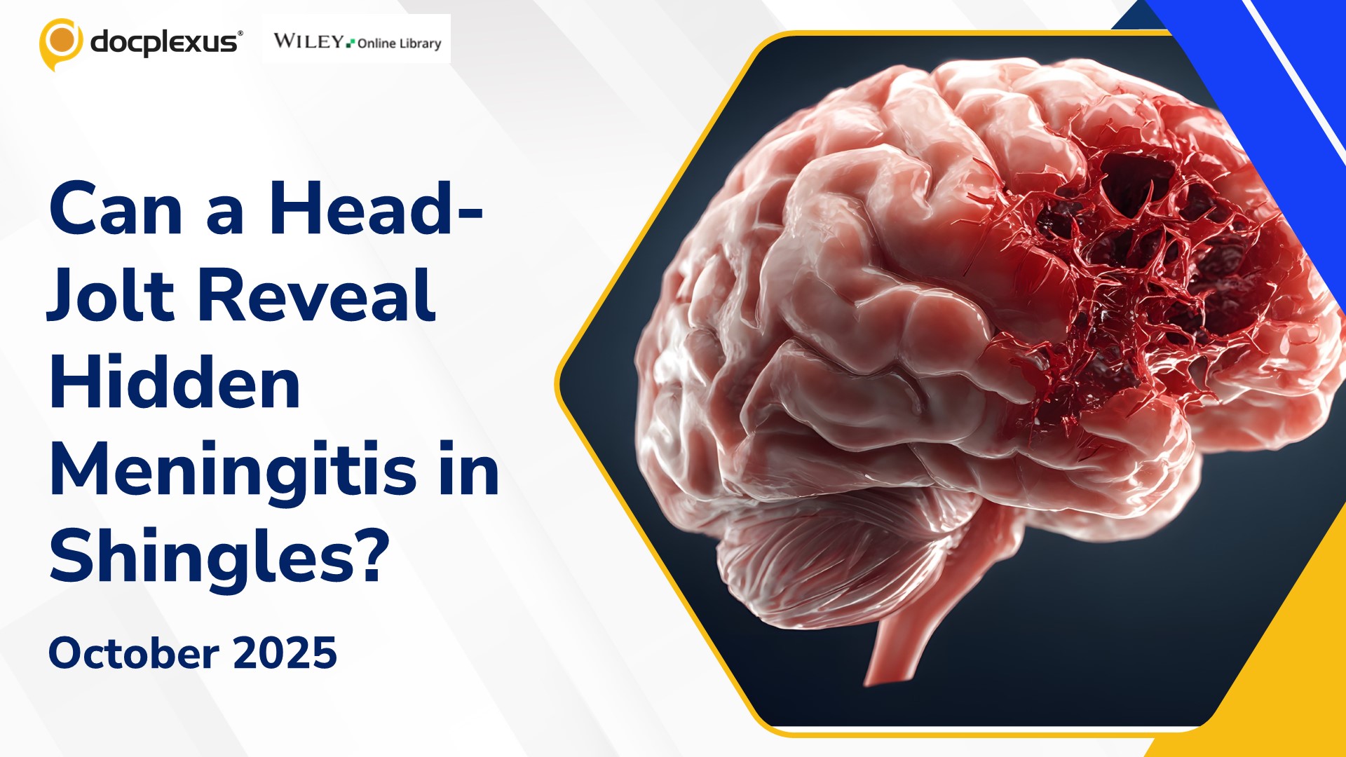 Can a Head-Jolt Reveal Hidden Meningitis in Shingles?