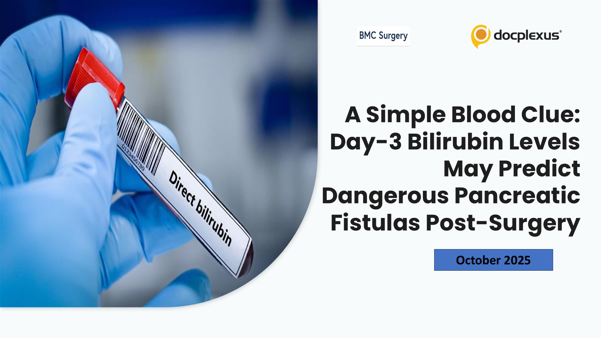 A Simple Blood Clue: Day-3 Bilirubin Levels May Predict Dangerous Pancreatic Fistulas Post-Surgery