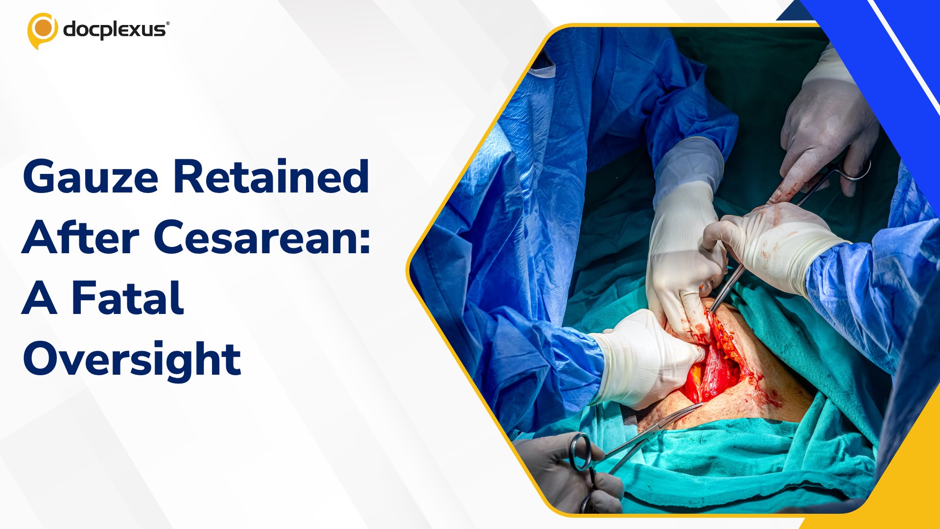Dehradun Woman Dies Due to Retained Surgical Gauze Post-Cesarean