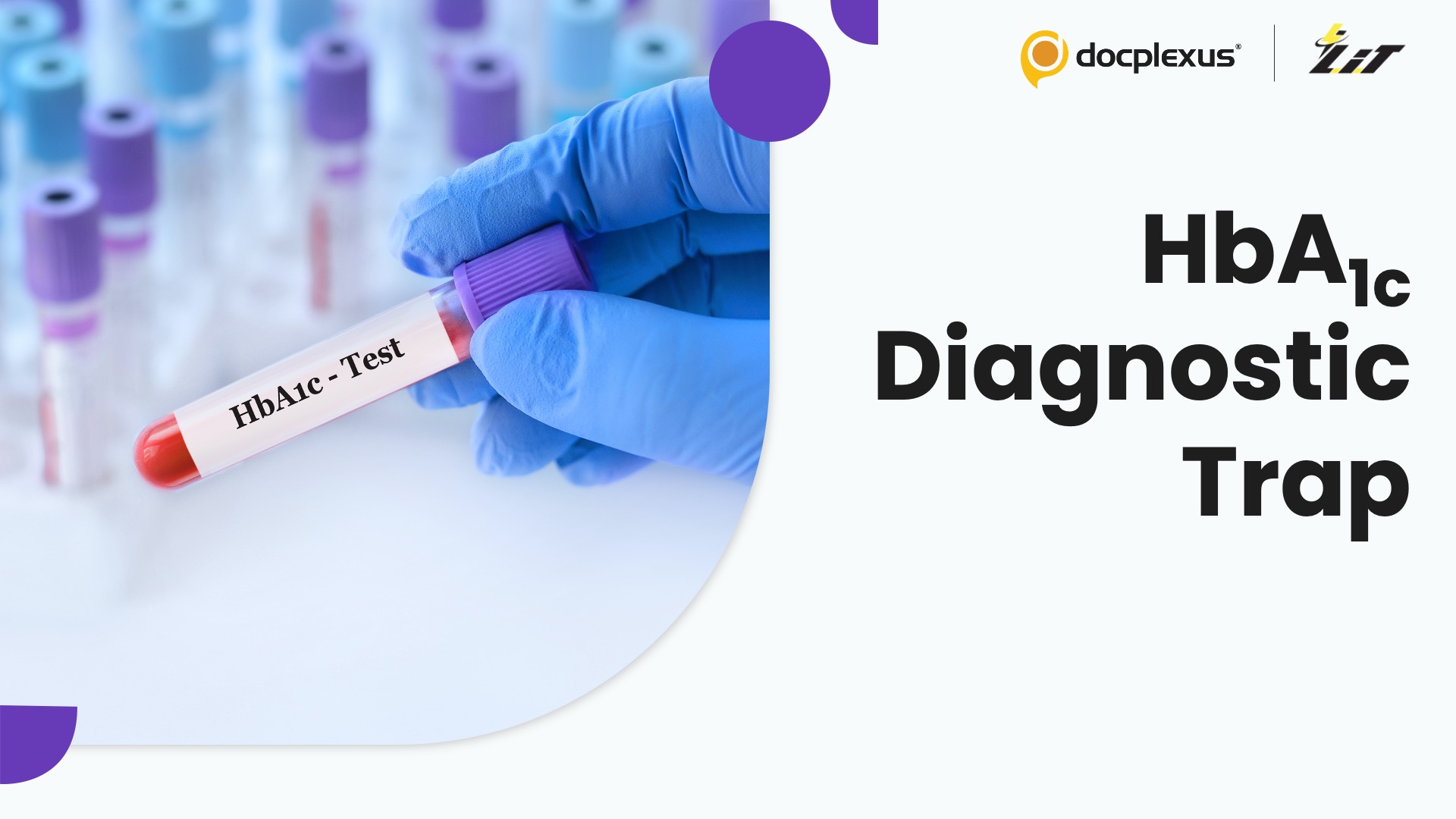 Genetic Condition That Hides Diabetes