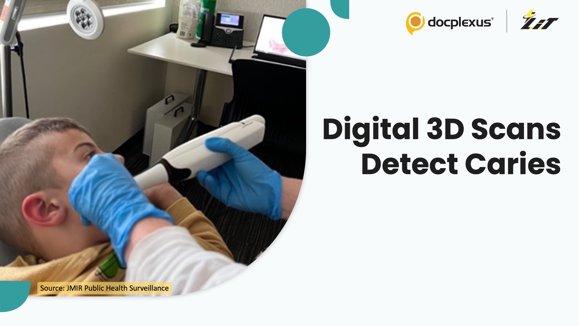 Intraoral Scanners Match Visual Exams in Detecting Dental Caries