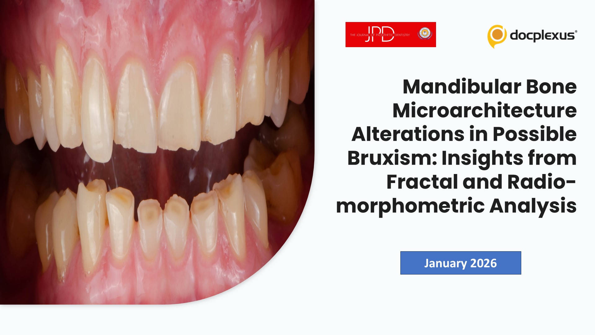 Mandibular Bone Microarchitecture Alterations in Possible Bruxism: Insights from Fractal and Radiomorphometric Analysis