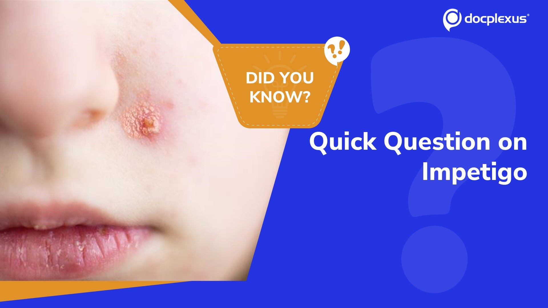 Impetigo: Key Insights & Quick Quiz