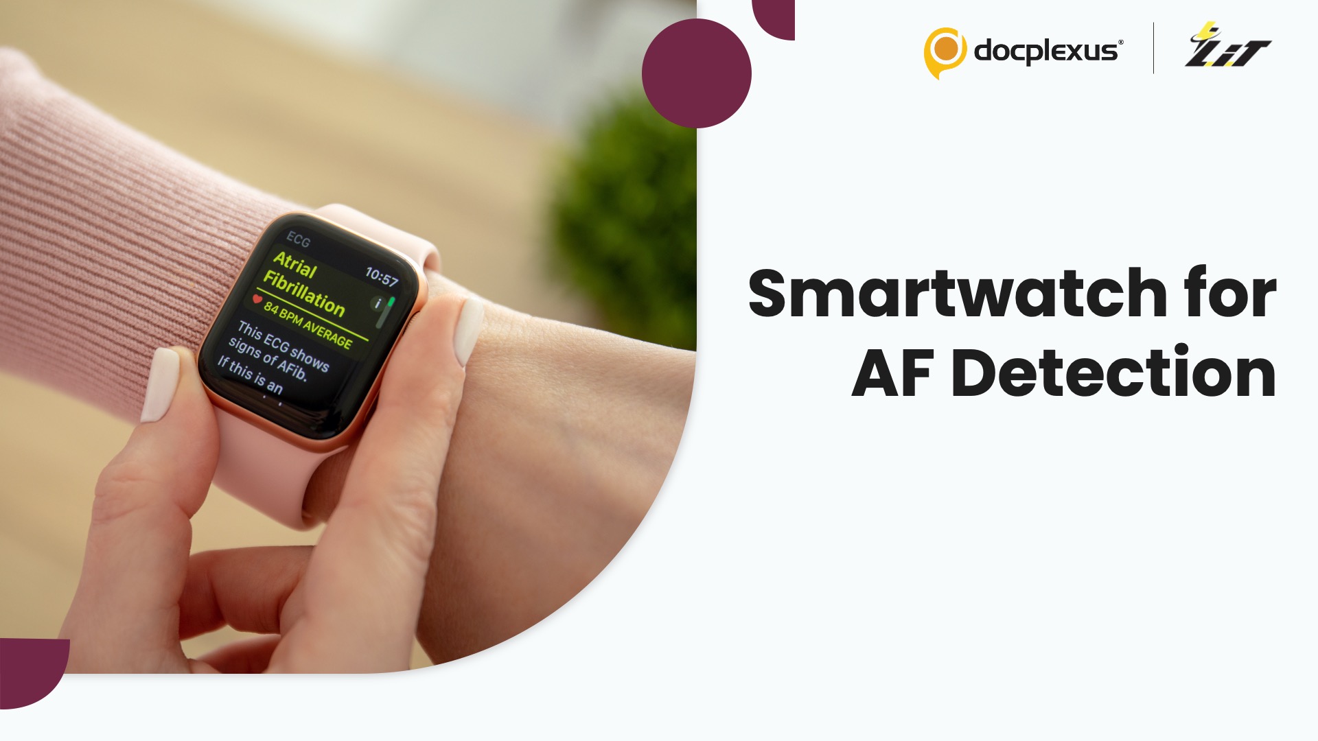 Can a Smartwatch Detect Atrial Fibrillation Earlier?
