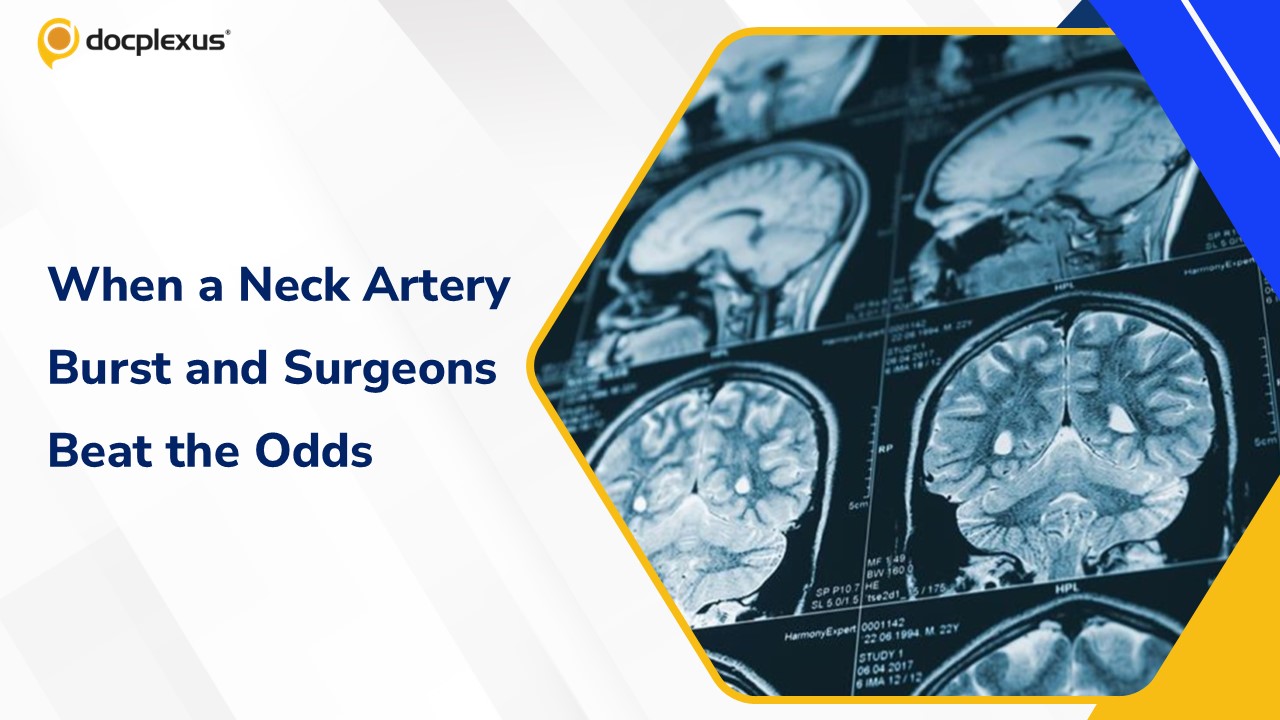 Chhattisgarh Surgeons Save Patient from Ultra-Rare Spontaneous Carotid Artery Rupture