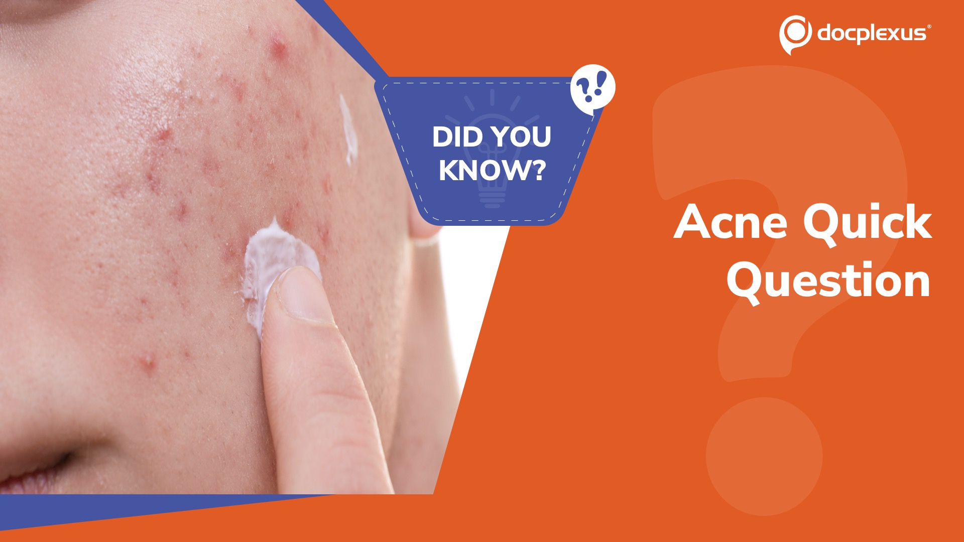 Acne Therapy Basics: Do You Know How This Drug Really Works?
