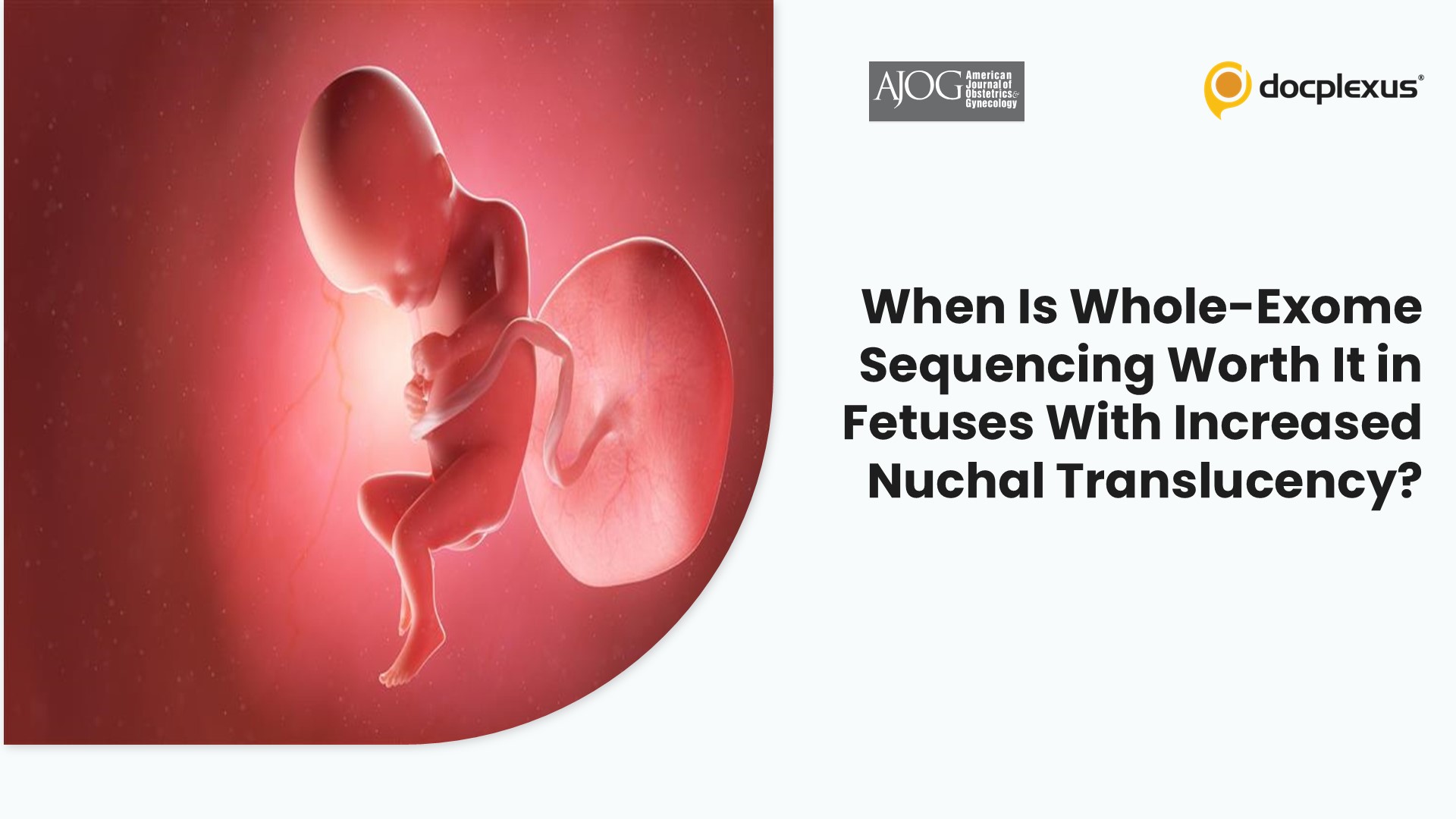 When Is Whole-Exome Sequencing Worth It in Fetuses With Increased Nuchal Translucency?