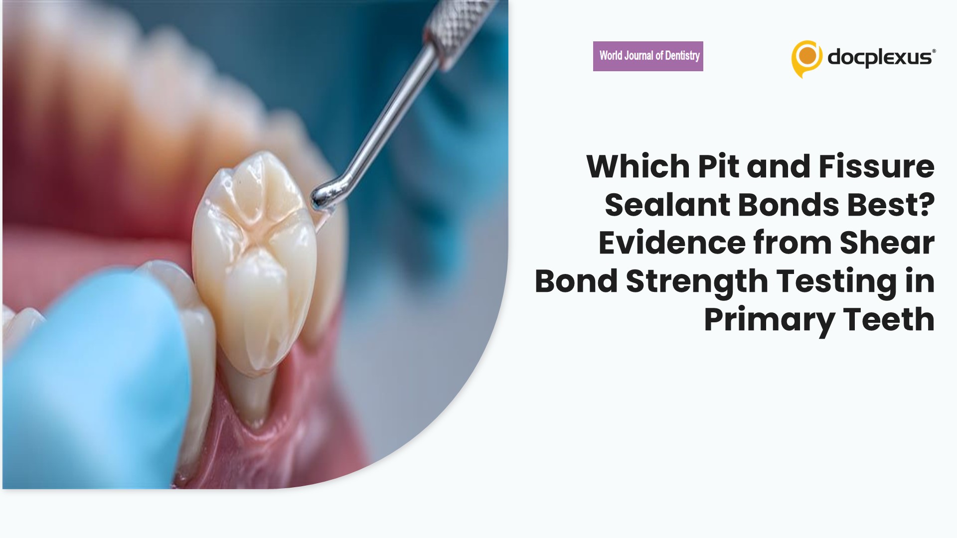 Which Pit and Fissure Sealant Bonds Best? Evidence from Shear Bond Strength Testing in Primary Teeth