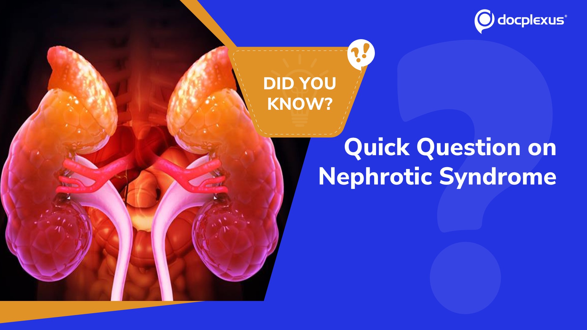 Test Your Knowledge of Nephrotic Syndrome!
