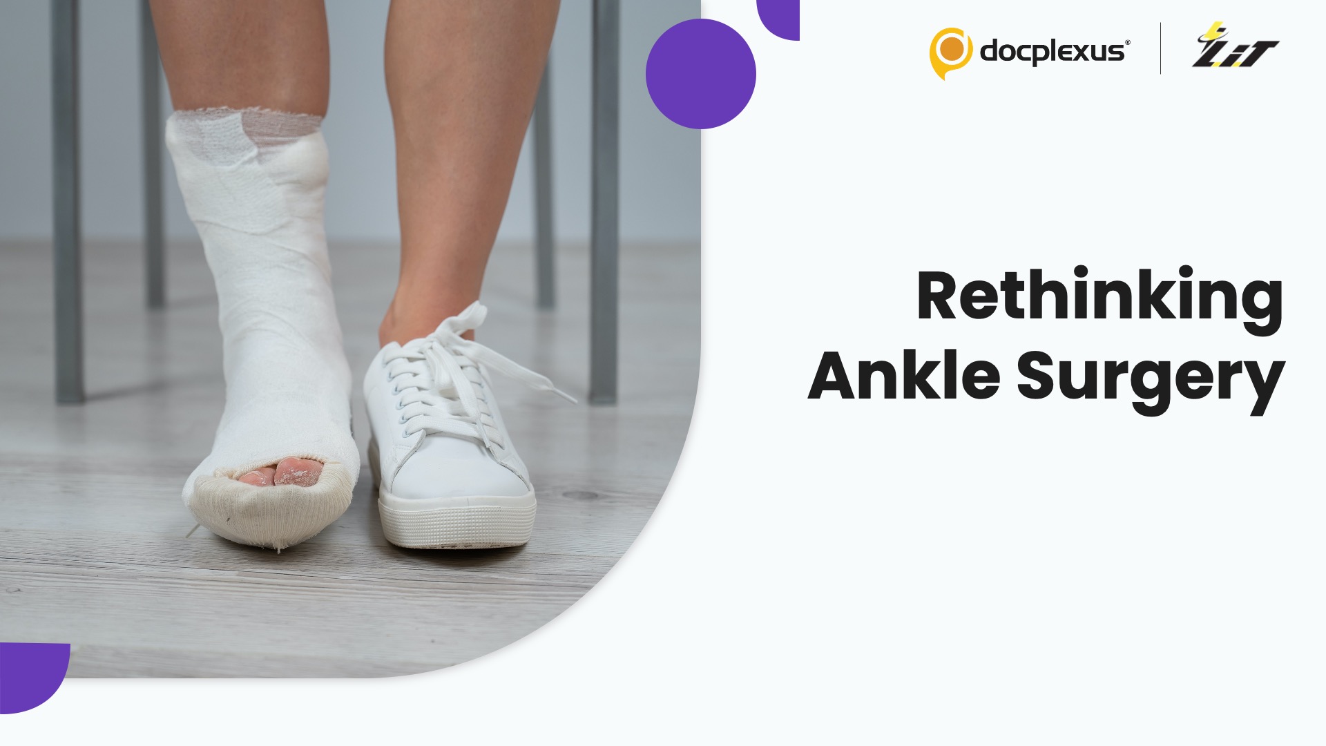 Cast Immobilization or Surgery for Unstable Weber B Ankle Fractures?