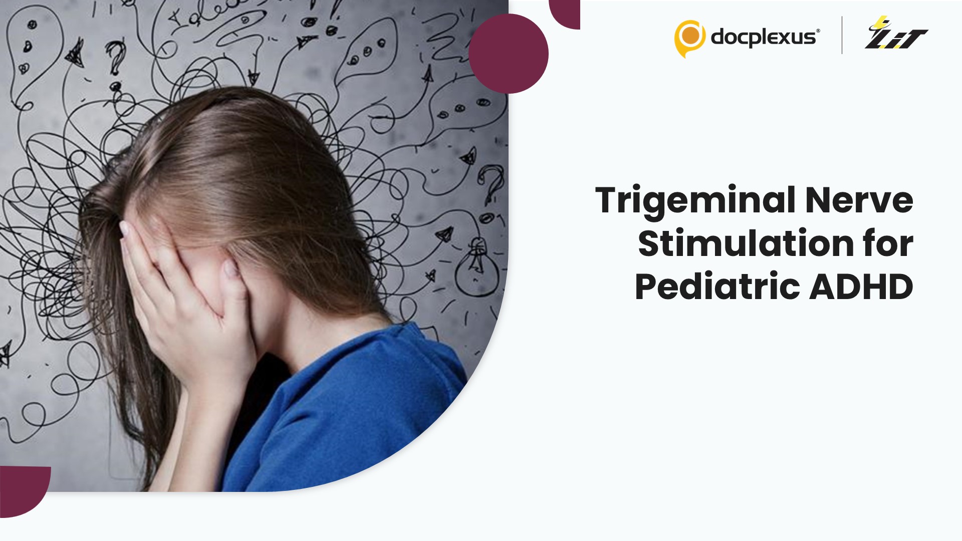 Is FDA-Approved Trigeminal Nerve Stimulation Effective for Pediatric ADHD?