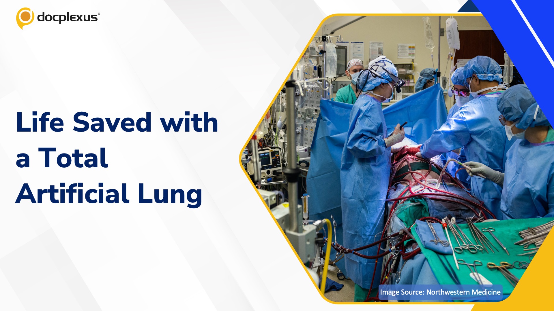 Surgeons Use Artificial Lung to Keep Patient Alive for 48 Hours Without Lungs