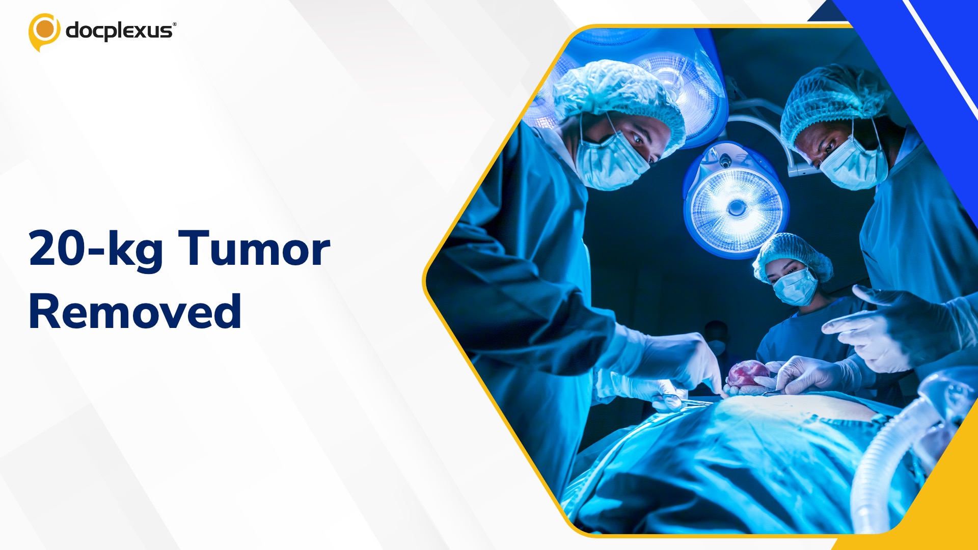 AIIMS Surgeons Remove 20-kg Tumor in Advanced Colon Cancer Patient