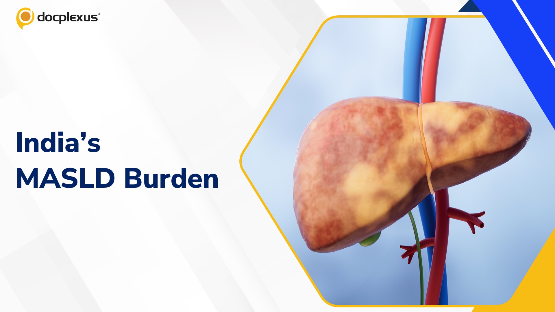 New Indian Data Reveal the Scale of Fatty Liver Disease