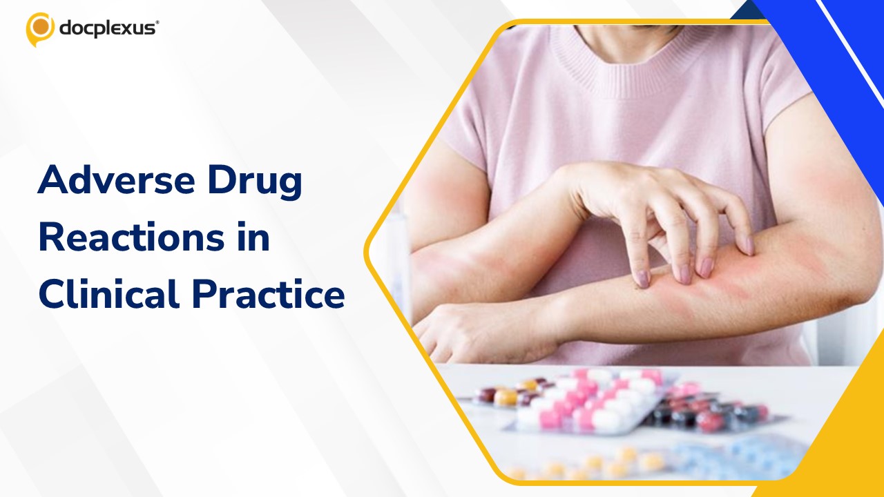 Adverse Drug Reactions in Routine Practice: Recognition and Prevention
