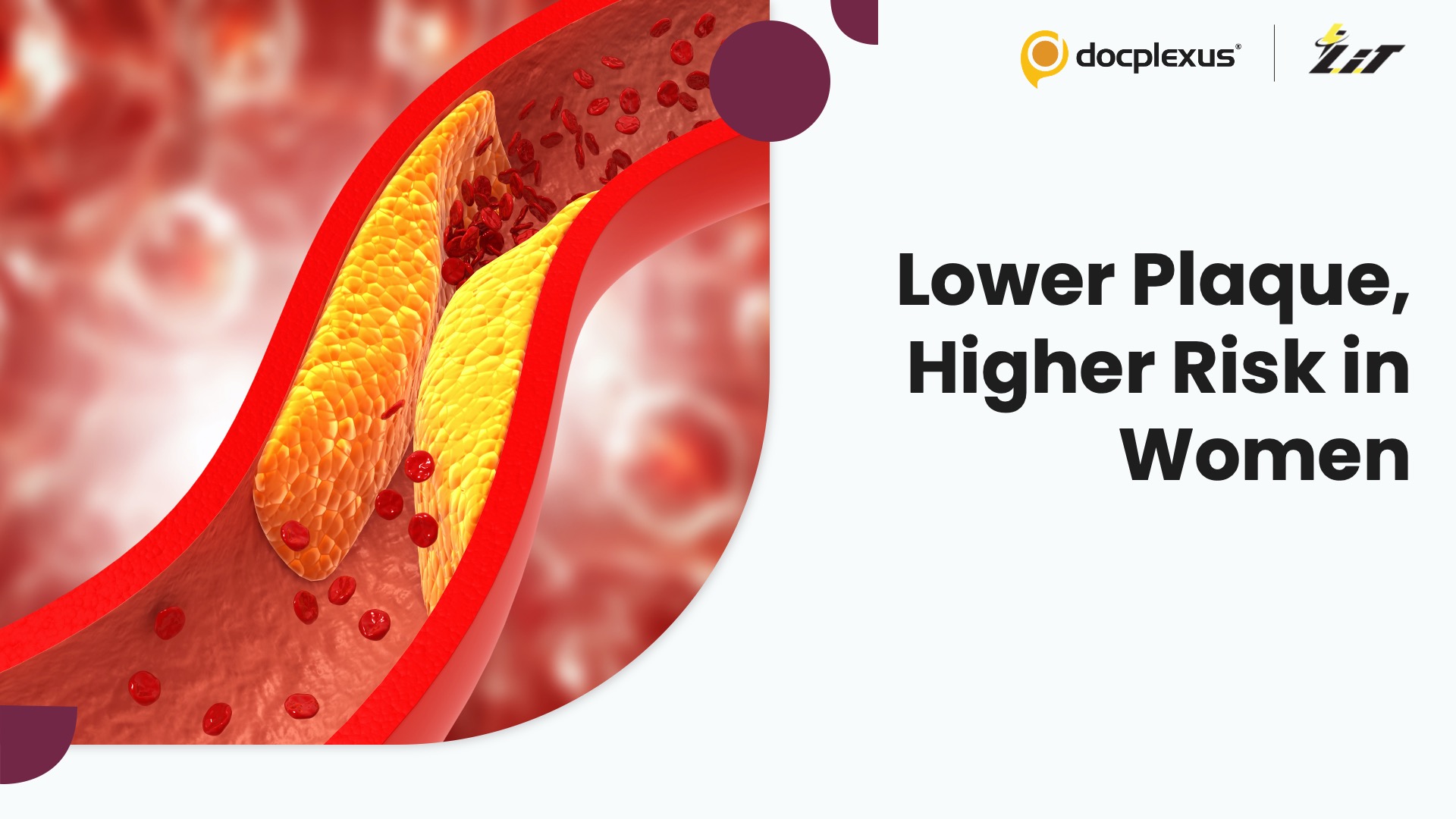 Women Develop Heart Risk at Lower Plaque Burden