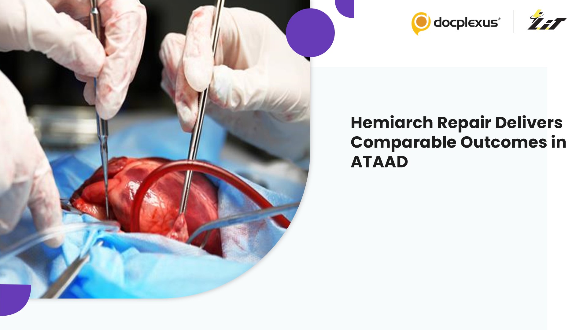 Hemiarch Repair Matches Outcomes in Older Patients with Acute Type A Aortic Dissection