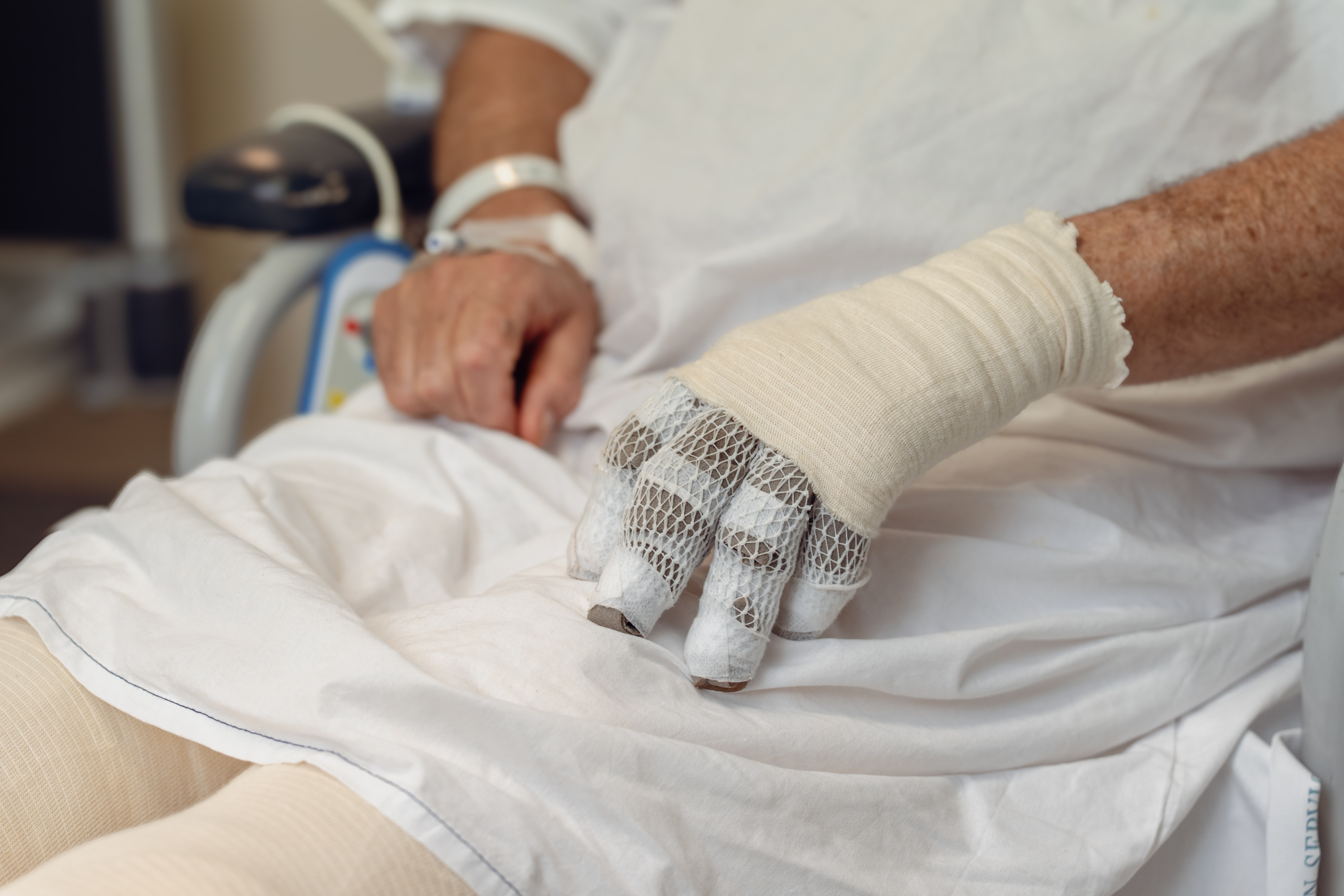 Delayed Ileal Perforation After Electrical Burn: A Rare but Lethal Complication
