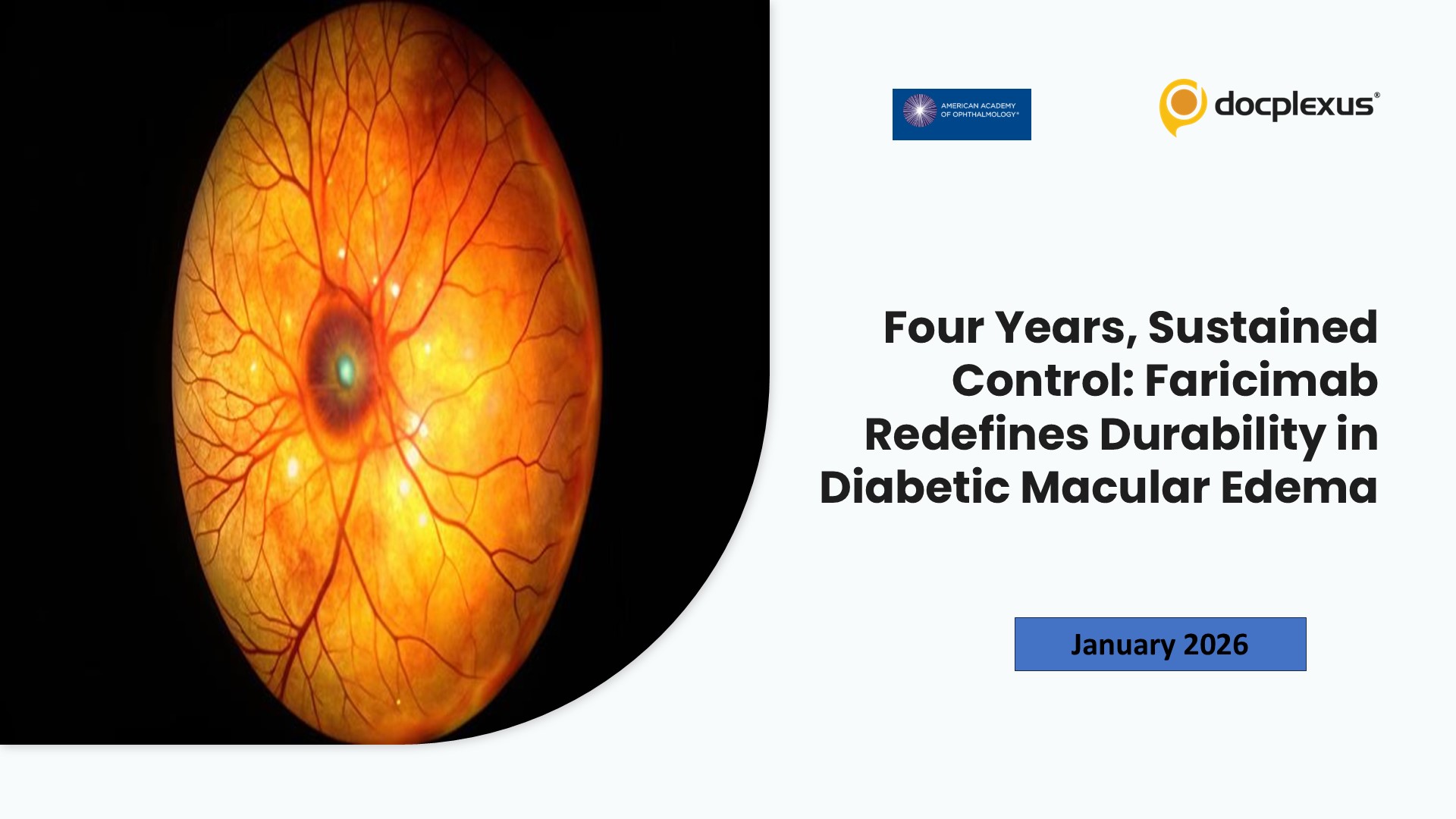 Four Years, Sustained Control: Faricimab Redefines Durability in Diabetic Macular Edema