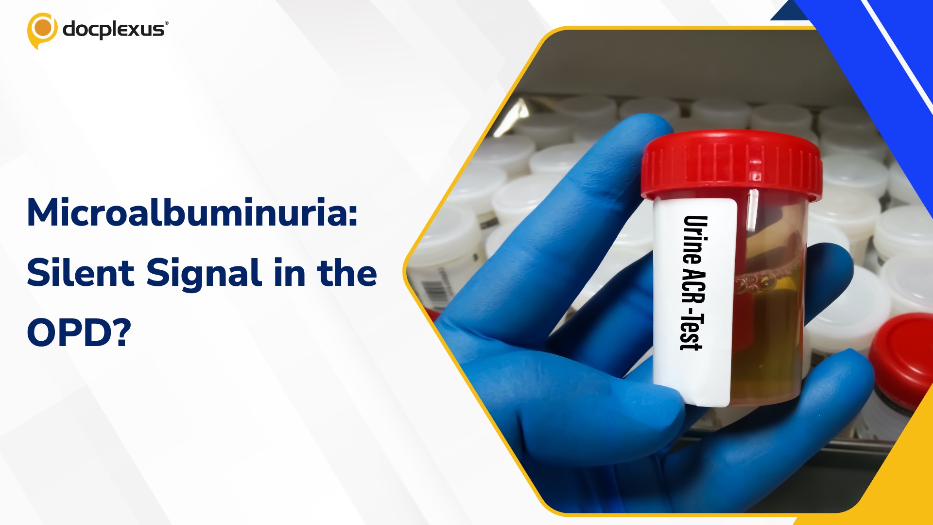 Incidental Microalbuminuria in the OPD: Early Warning Sign or Overlooked Finding?