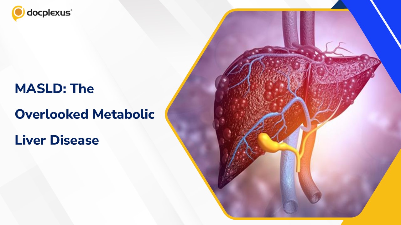 MASLD: The Silent Metabolic Liver Disease Hiding in Plain Sight