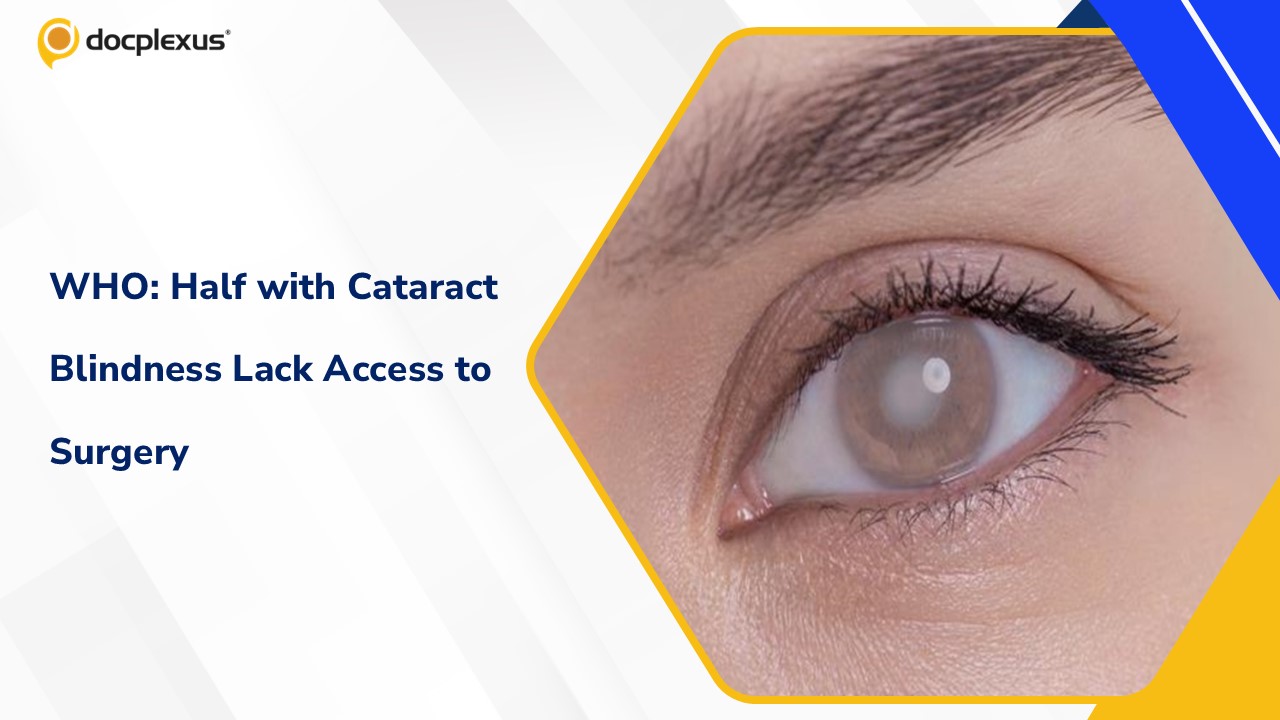 WHO Reports Half of Those with Cataract Blindness Lack Access to Sight-Restoring Surgery