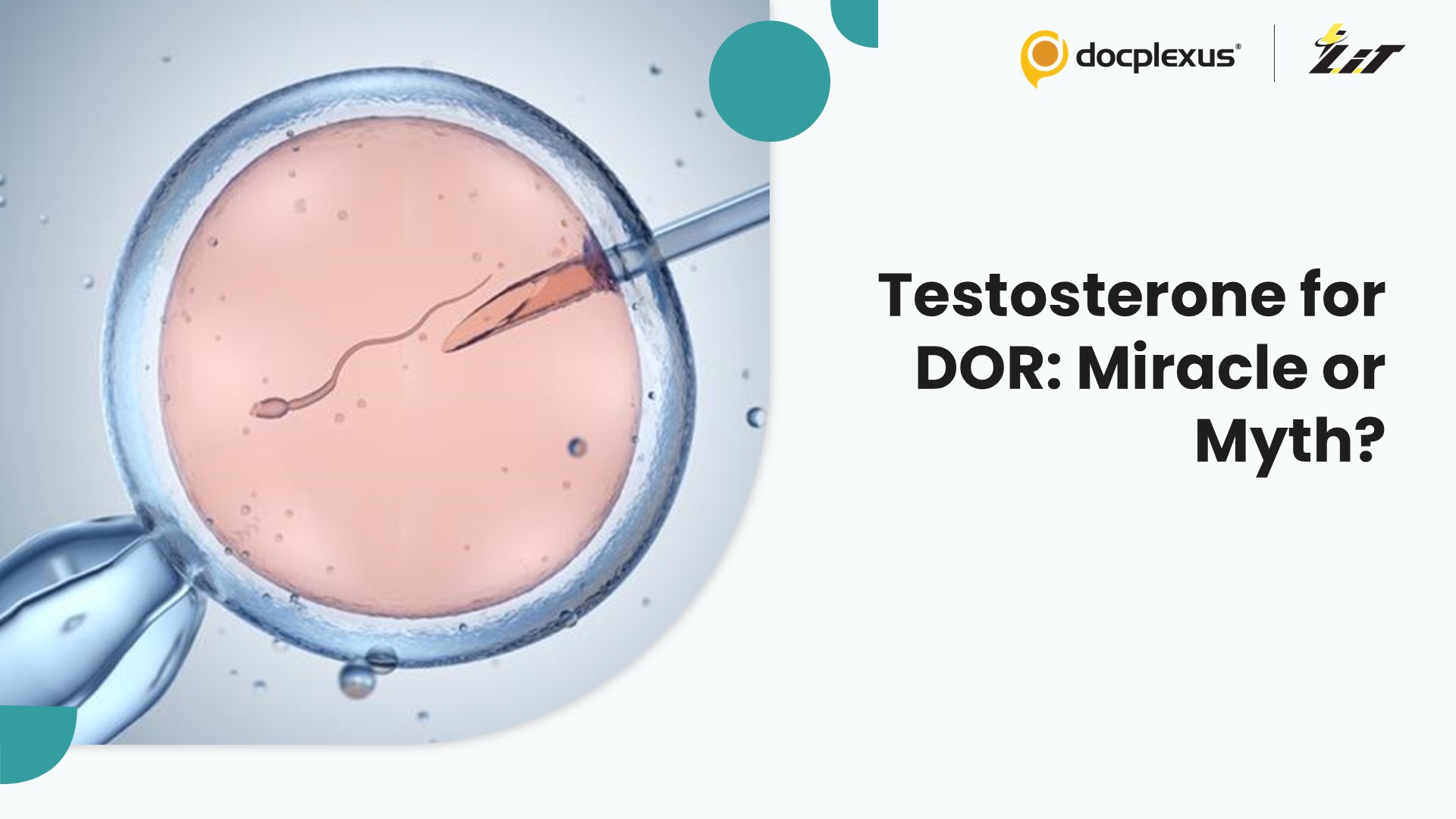 IVF Add-On Under Fire: Does Testosterone Really Help DOR Patients?