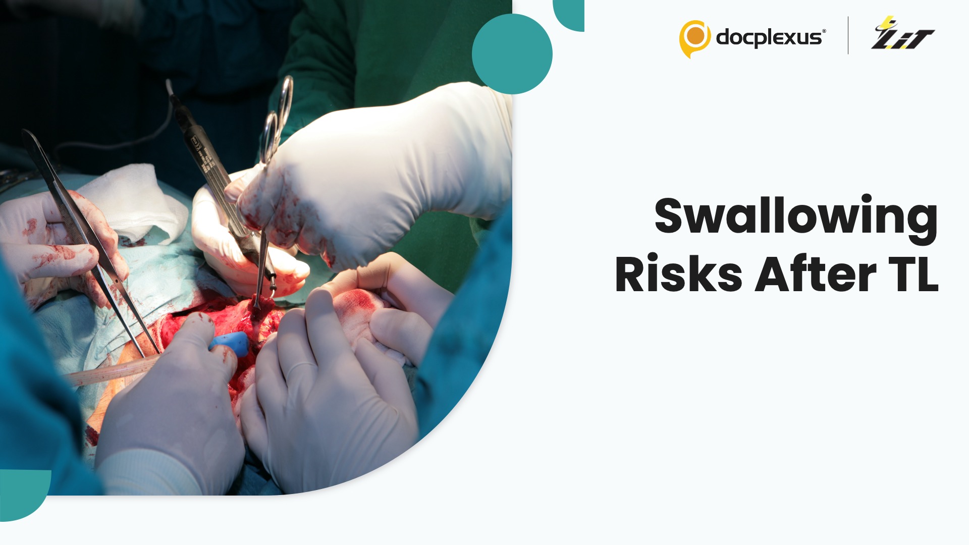 Dysphagia After Total Laryngectomy: Who Is Most at Risk?